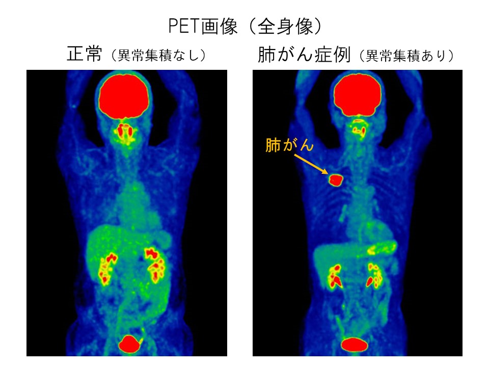 Ct と は pet